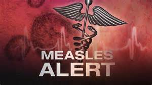 measles