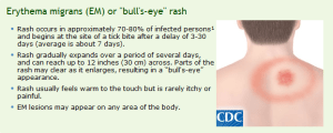 erythema-migrans-lyme-disease1
